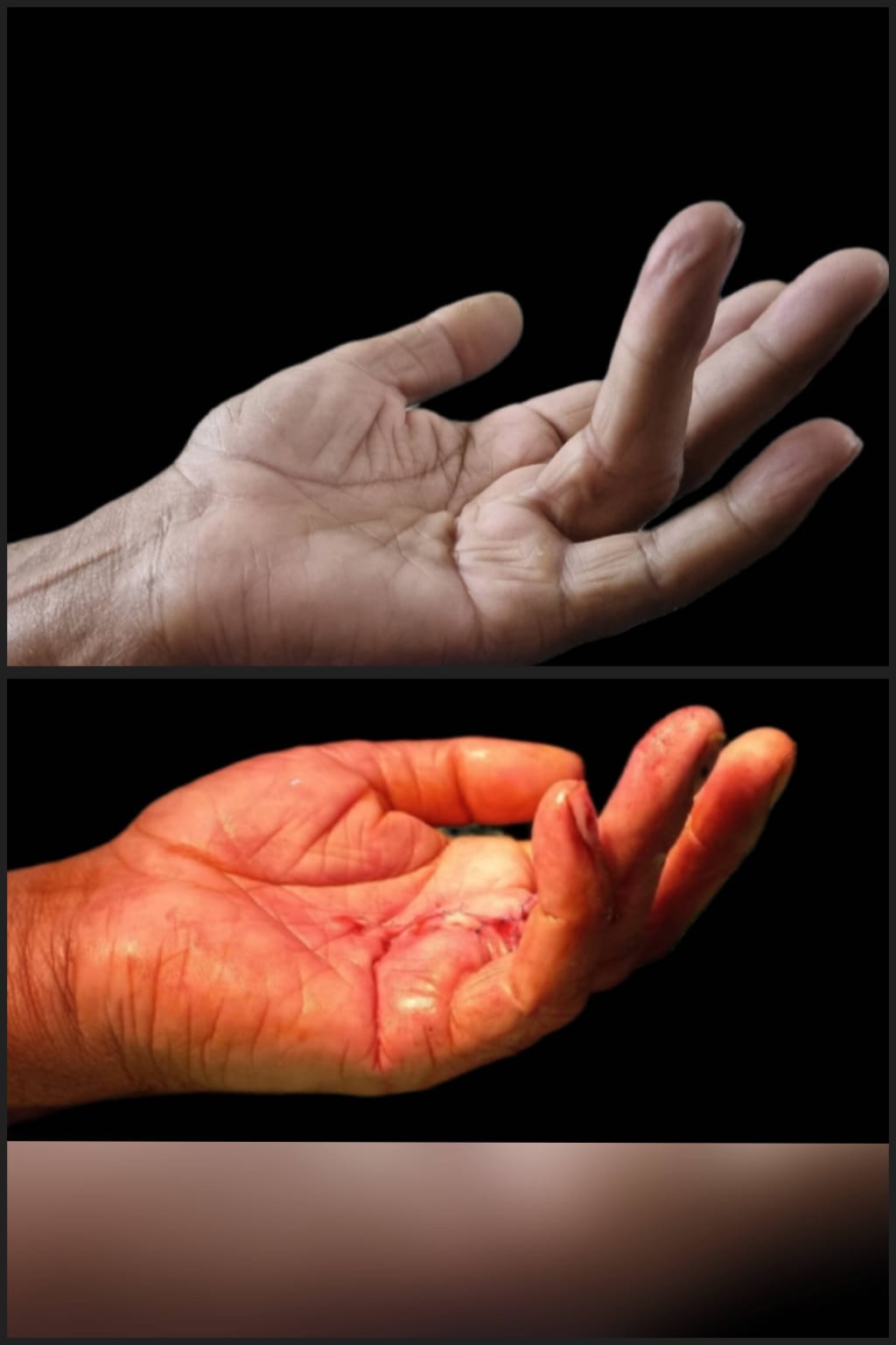 Before & After 58